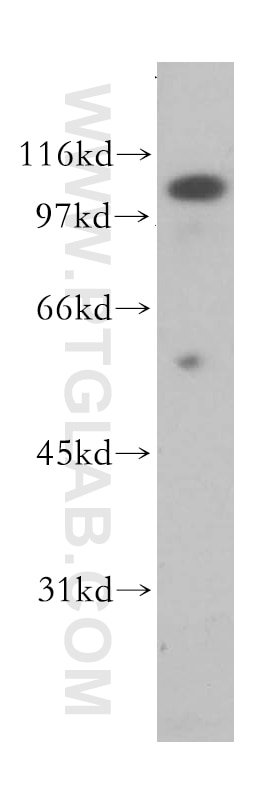 Western Blot (WB) analysis of human liver tissue using PSMA/GCPII Polyclonal antibody (13163-1-AP)