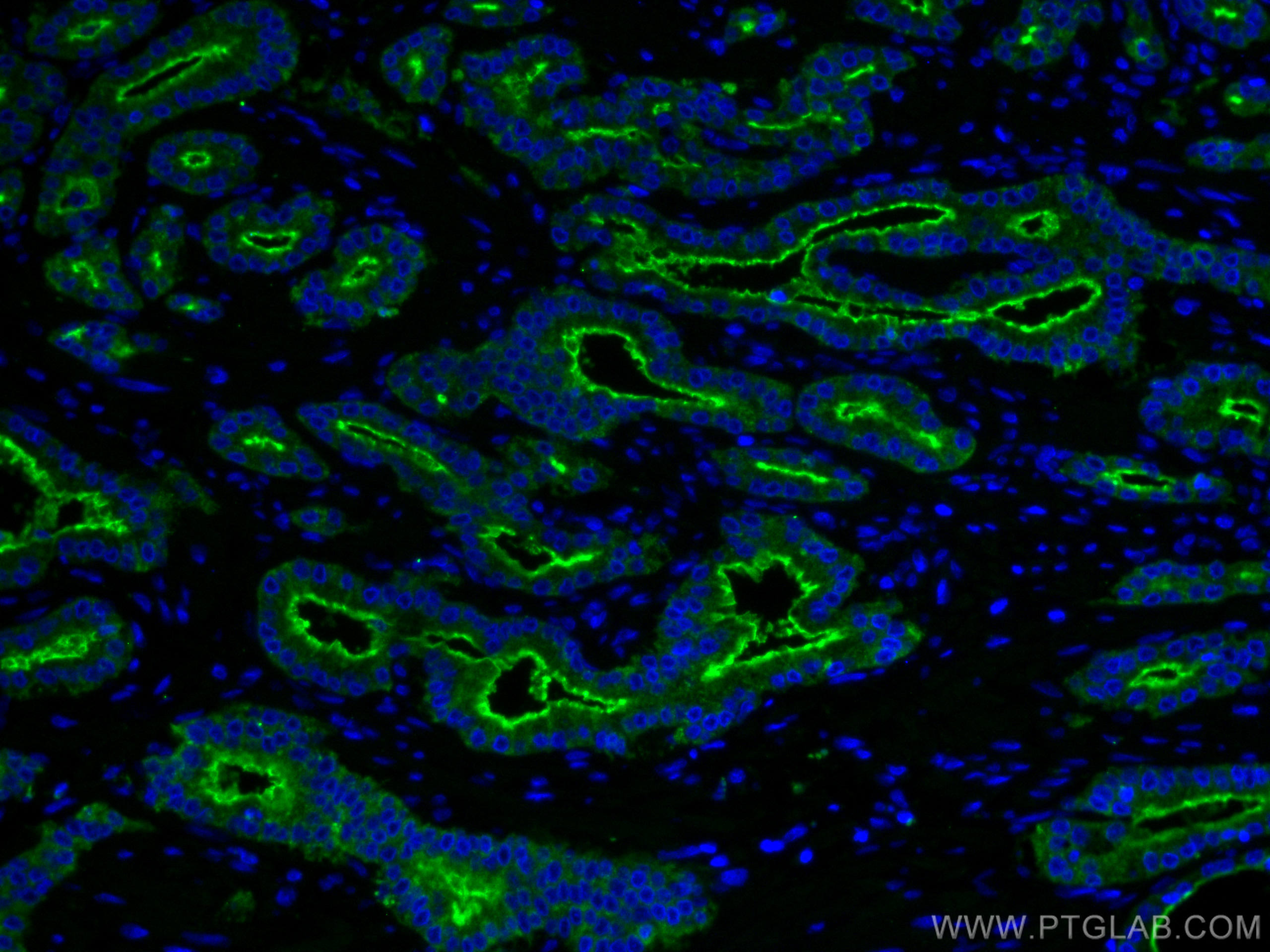 Immunofluorescence (IF) / fluorescent staining of human prostate cancer tissue using PSMA/GCPII Monoclonal antibody (66678-1-Ig)