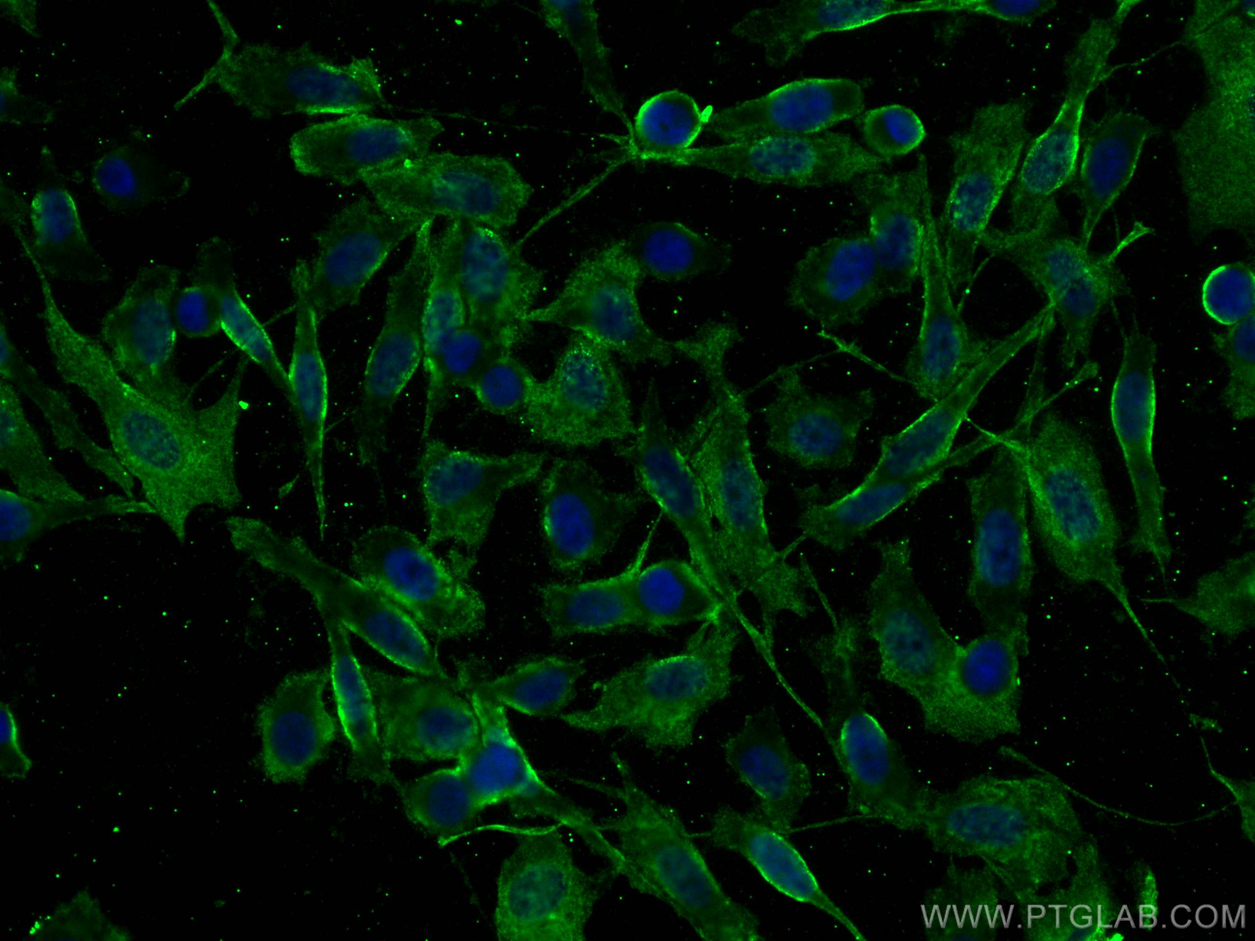 Immunofluorescence (IF) / fluorescent staining of PC-3 cells using PSMA/GCPII Monoclonal antibody (66678-1-Ig)