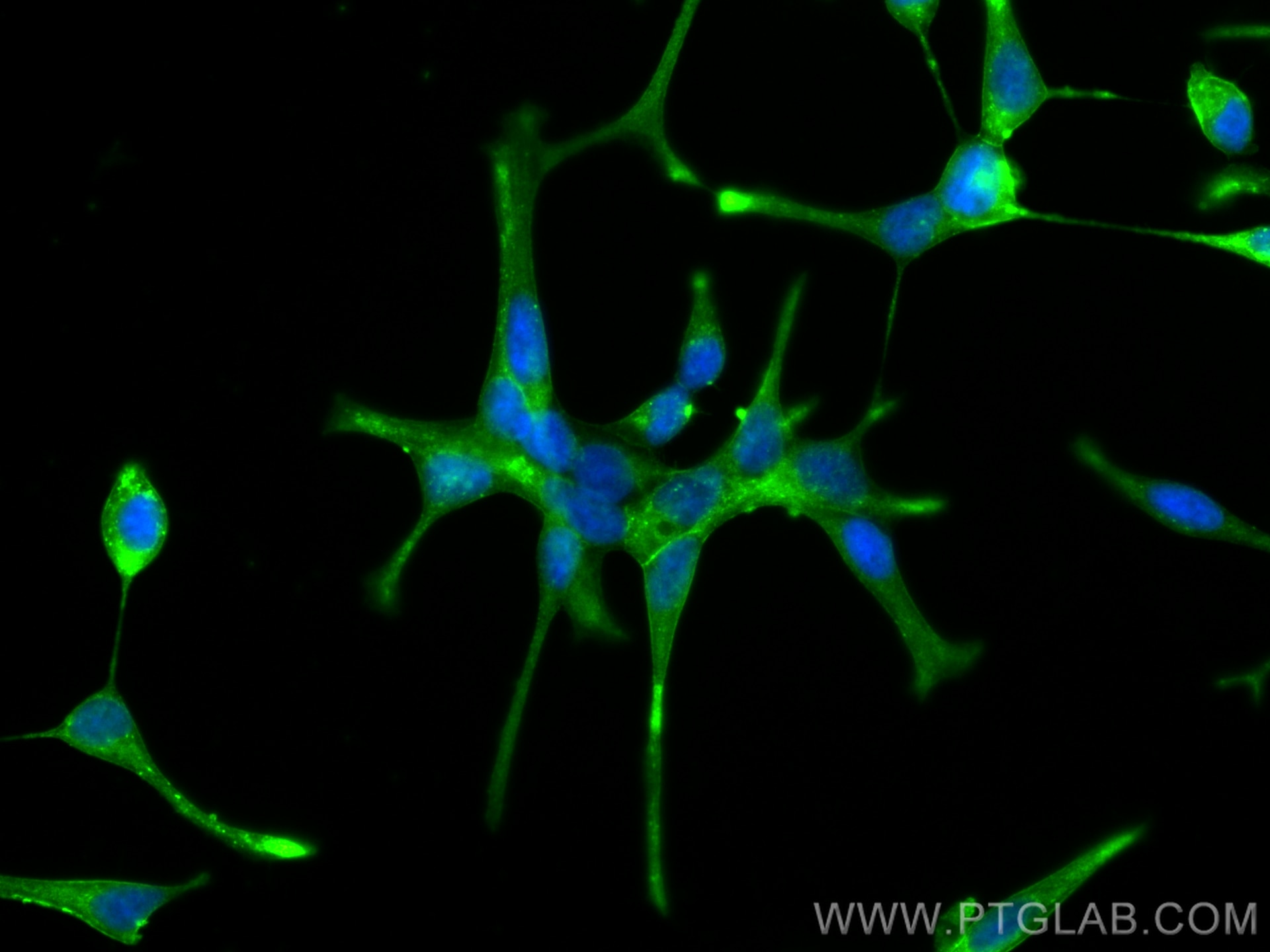 Immunofluorescence (IF) / fluorescent staining of LNCaP cells using PSMA/GCPII Monoclonal antibody (66678-1-Ig)