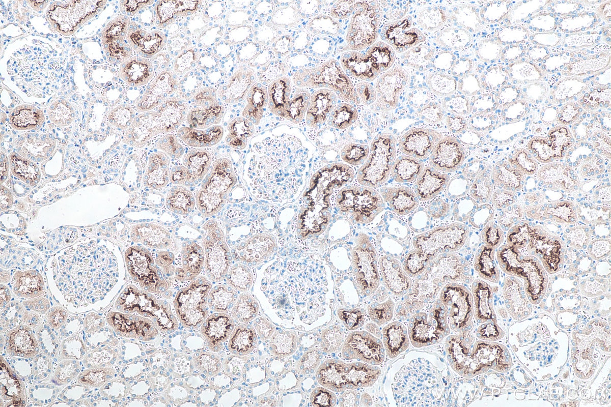IHC staining of human kidney using 66678-1-Ig Immunohistochemistry (IHC) staining of human kidney tissue using PSMA/GCPII Monoclonal antibody (66678-1-Ig)