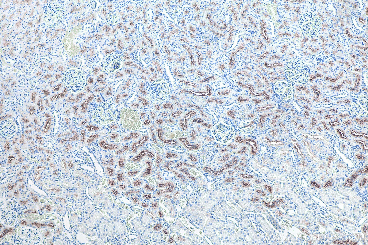 IHC staining of rat kidney using 66678-1-Ig Immunohistochemistry (IHC) staining of rat kidney tissue using PSMA/GCPII Monoclonal antibody (66678-1-Ig)