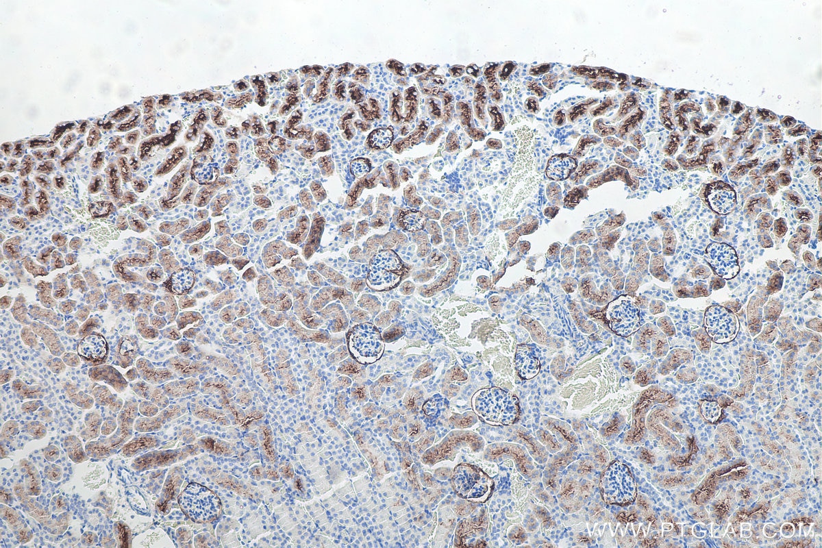 Immunohistochemistry (IHC) staining of mouse kidney tissue using PSMA/GCPII Monoclonal antibody (66678-1-Ig)
