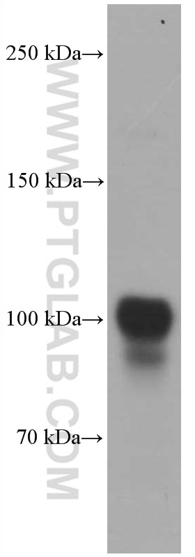 Western Blot (WB) analysis of LNCaP cells using PSMA/GCPII Monoclonal antibody (66678-1-Ig)