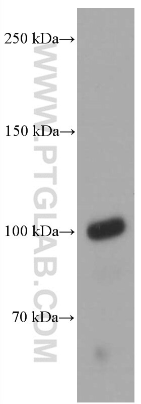 WB analysis of rat kidney using 66678-1-Ig