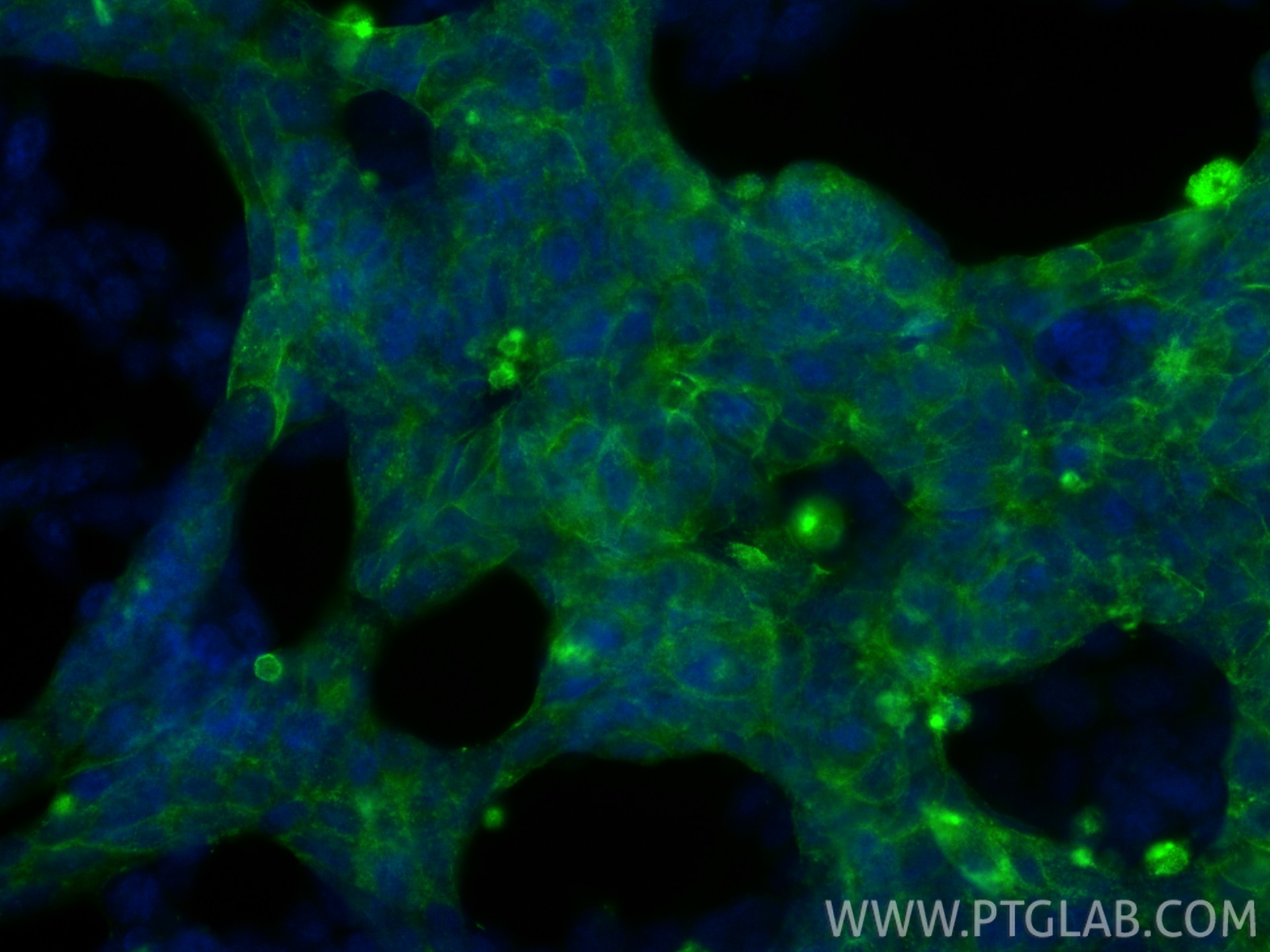 IF Staining of LNCaP using 84615-2-RR Immunofluorescence (IF) / fluorescent staining of LNCaP cells using PSMA/GCPII Recombinant monoclonal antibody (84615-2-RR)