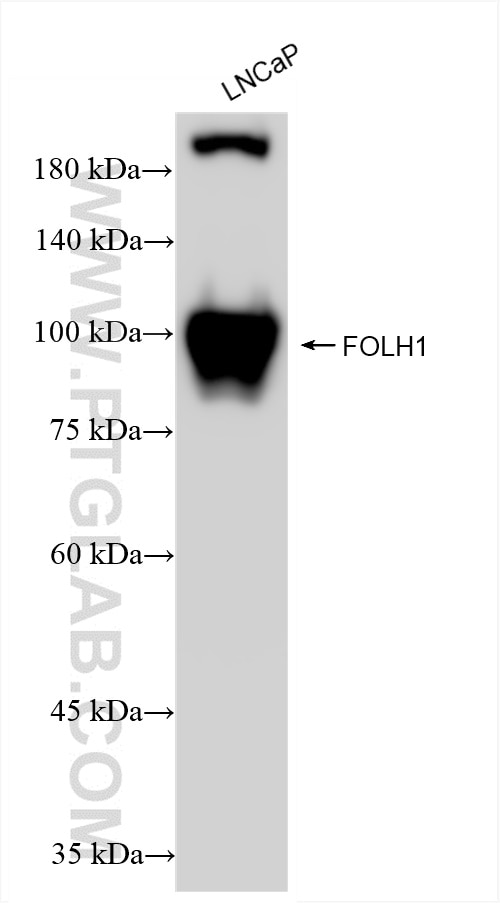Western Blot (WB) analysis of LNCaP cells using PSMA/GCPII Recombinant antibody (84615-2-RR)