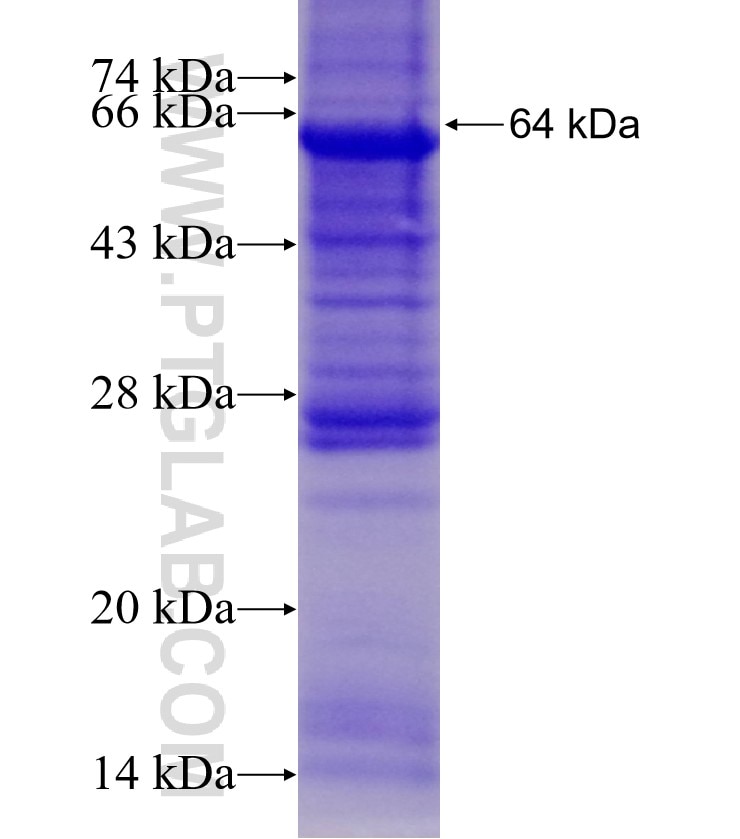 FOLH1 fusion protein Ag3812 SDS-PAGE