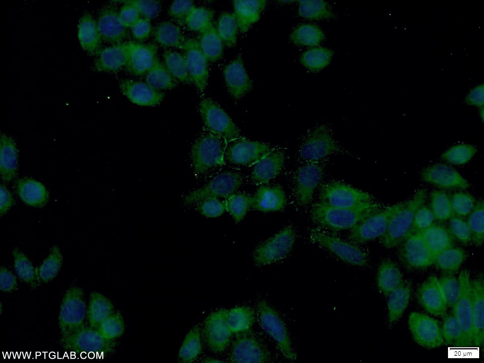 Immunofluorescence (IF) / fluorescent staining of HeLa cells using FOLR1 Polyclonal antibody (23355-1-AP)