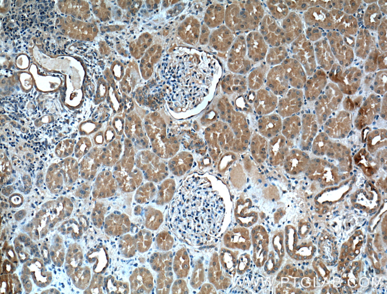 Immunohistochemistry (IHC) staining of human kidney tissue using FOLR1 Monoclonal antibody (60307-1-Ig)