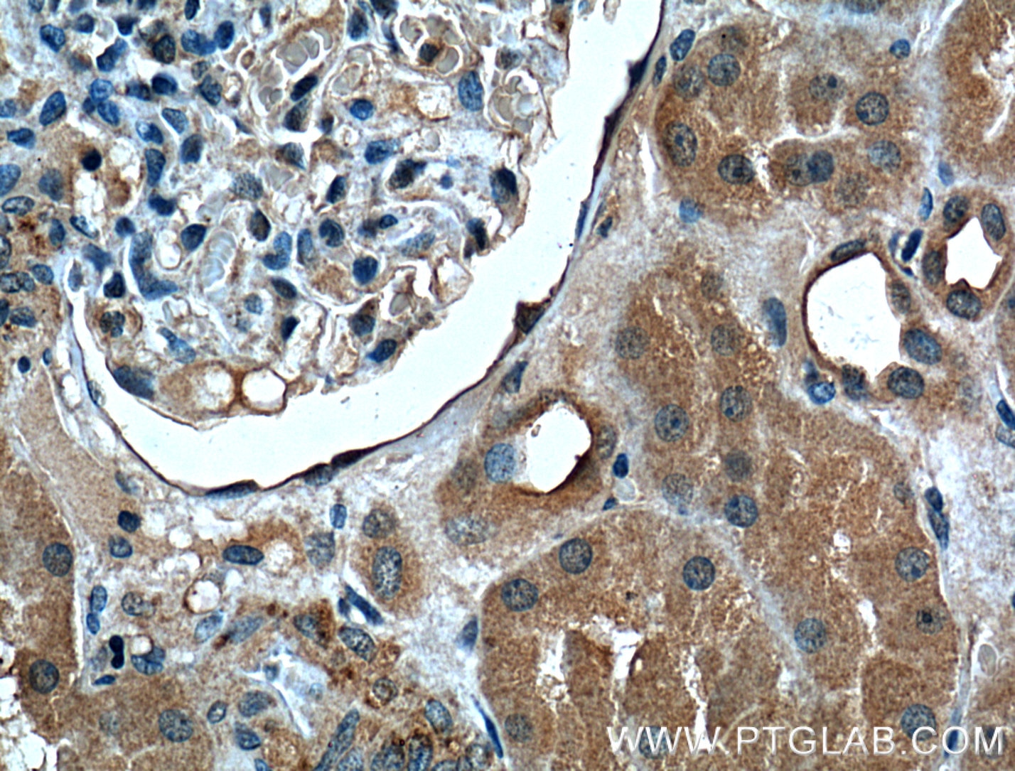 Immunohistochemistry (IHC) staining of human kidney tissue using FOLR1 Monoclonal antibody (60307-1-Ig)