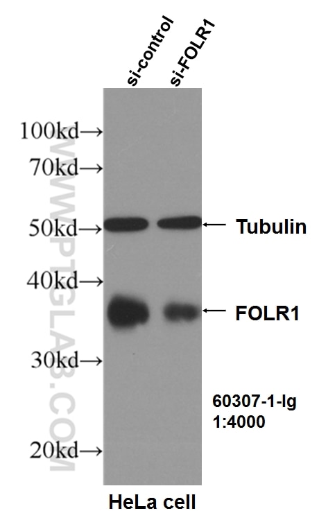 Western Blot (WB) analysis of HeLa cells using FOLR1 Monoclonal antibody (60307-1-Ig)