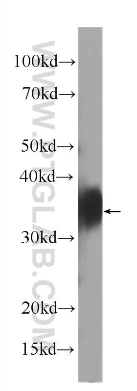 FOLR1 Monoclonal antibody