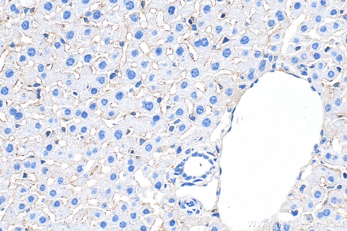 Immunohistochemistry (IHC) staining of mouse liver tissue using FOLR2 Polyclonal antibody (31264-1-AP)