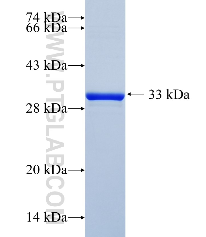 FOLR3 fusion protein Ag35928 SDS-PAGE FOLR3 fusion protein Ag35928 SDS-PAGE