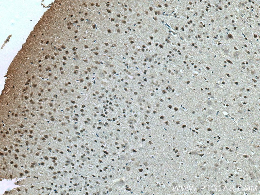 Immunohistochemistry (IHC) staining of mouse brain tissue using c-Fos Polyclonal antibody (26192-1-AP)