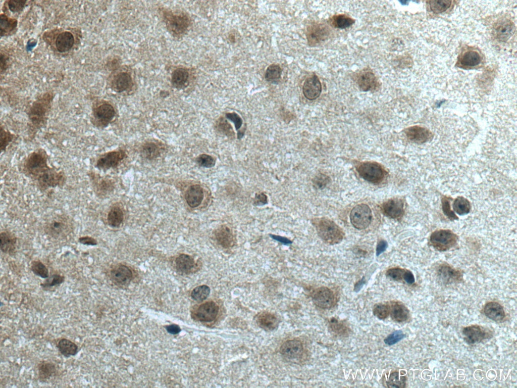 Immunohistochemistry (IHC) staining of mouse brain tissue using c-Fos Polyclonal antibody (26192-1-AP)