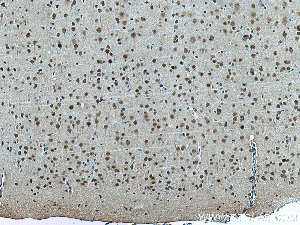 Immunohistochemistry (IHC) staining of rat brain tissue using c-Fos Polyclonal antibody (26192-1-AP)