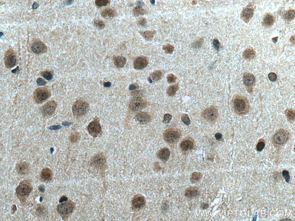 Immunohistochemistry (IHC) staining of rat brain tissue using c-Fos Polyclonal antibody (26192-1-AP)