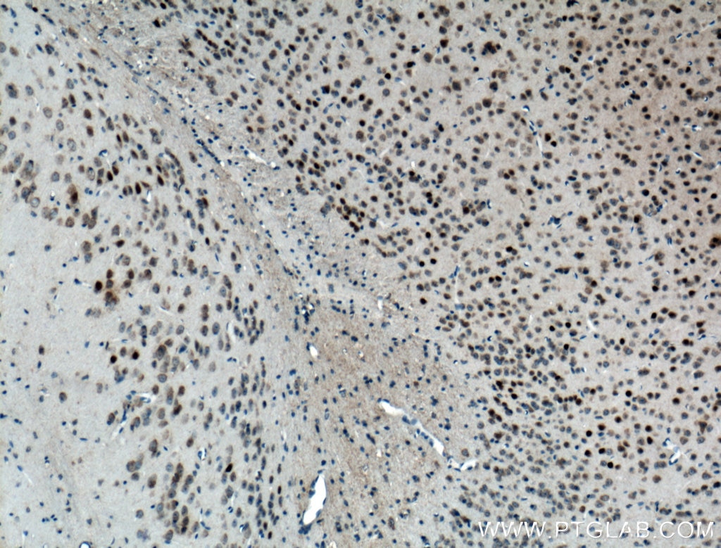 IHC staining of mouse brain using 66590-1-Ig