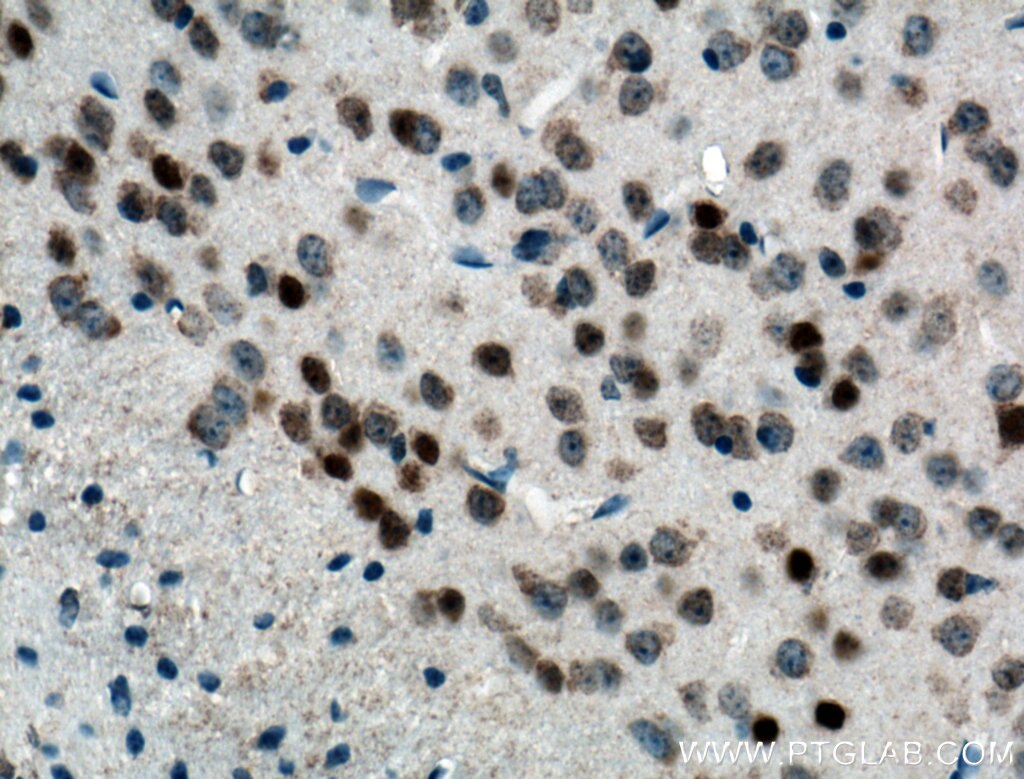 IHC staining of mouse brain using 66590-1-Ig