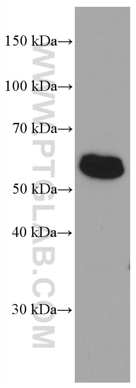 WB analysis of HeLa using 66590-1-Ig