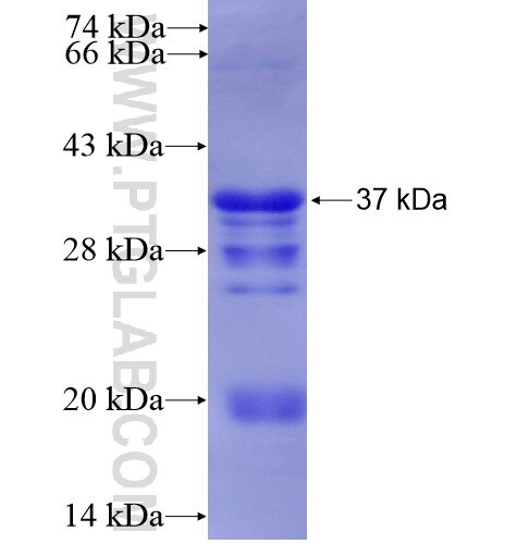 FOSB fusion protein Ag11923 SDS-PAGE
