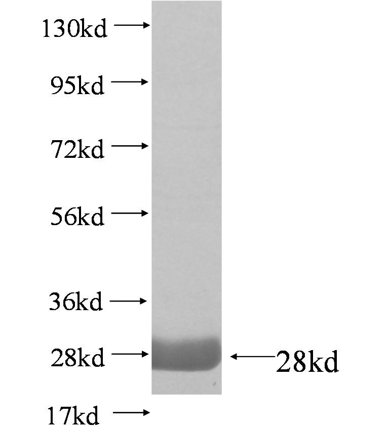 FOSB fusion protein Ag4209 SDS-PAGE