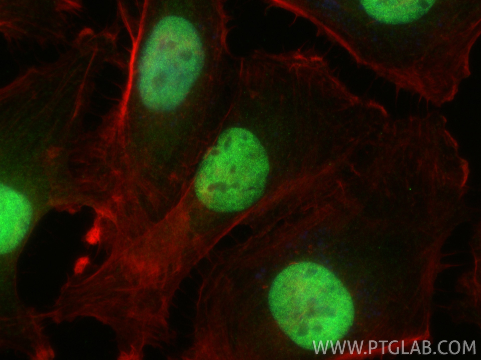 IF Staining of U-251 using 12663-1-AP (same clone as 12663-1-PBS) Immunofluorescence (IF) / fluorescent staining of U-251 cells using FOSL1 Polyclonal antibody (12663-1-AP)