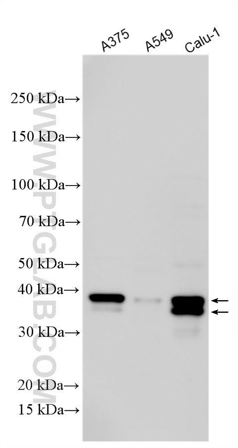 WB analysis using 12663-1-AP Western Blot (WB) analysis of various lysates using FOSL1 Polyclonal antibody (12663-1-AP)