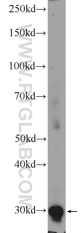 Western Blot (WB) analysis of Jurkat cells using FOSL2 Polyclonal antibody (15832-1-AP)