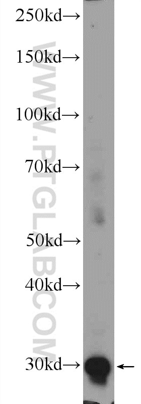 WB analysis of Jurkat using 15832-1-AP