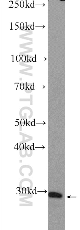 Western Blot (WB) analysis of PC-3 cells using FOSL2 Polyclonal antibody (15832-1-AP)