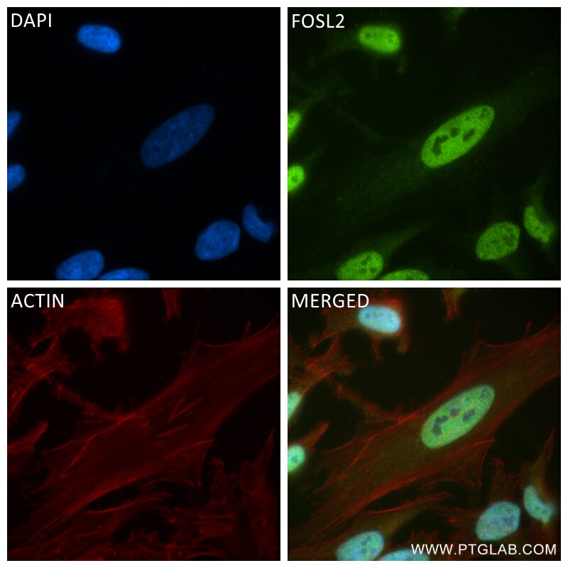 Immunofluorescence (IF) / fluorescent staining of HeLa cells using FOSL2 Recombinant antibody (84718-5-RR)