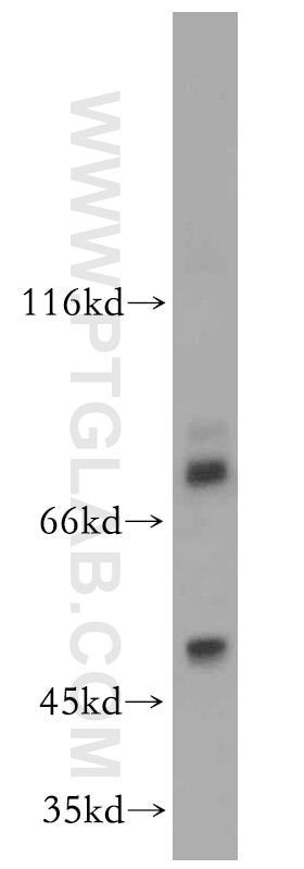 FOXA1 Polyclonal antibody