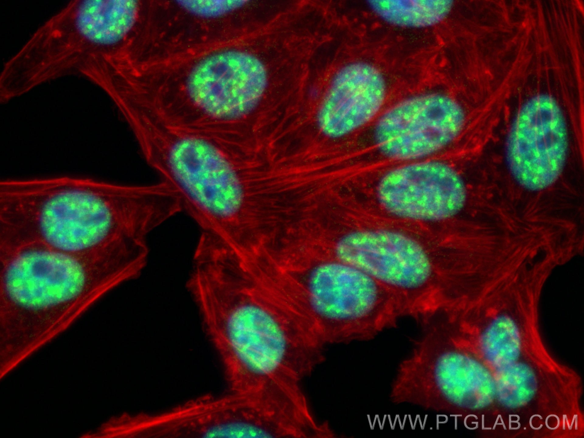 Immunofluorescence (IF) / fluorescent staining of HepG2 cells using FOXA1 Recombinant monoclonal antibody (85125-6-RR)