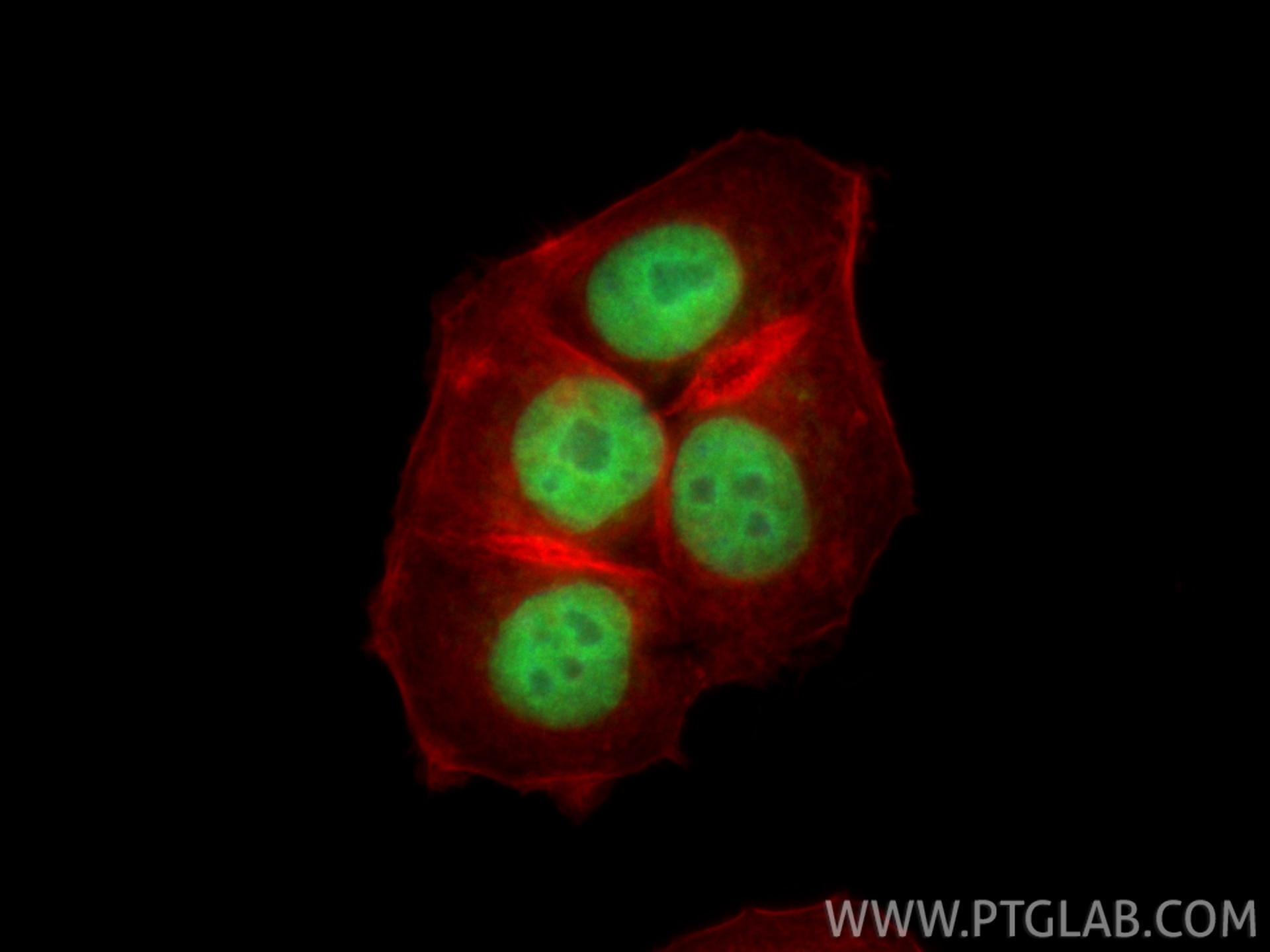 IF Staining of MCF-7 using CL488-85125-6 Immunofluorescence (IF) / fluorescent staining of MCF-7 cells using CoraLite® Plus 488-conjugated FOXA1 Recombinant mo (CL488-85125-6)