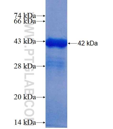 FOXA1 fusion protein Ag14243 SDS-PAGE