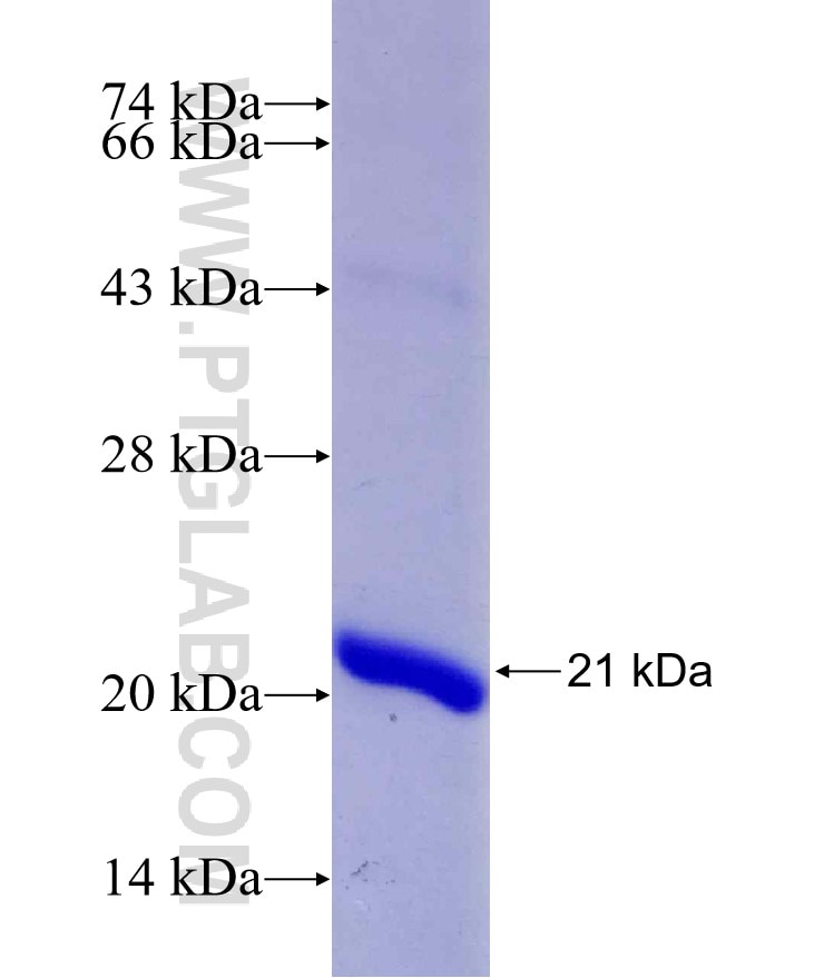 FOXA1 fusion protein Ag14502 SDS-PAGE