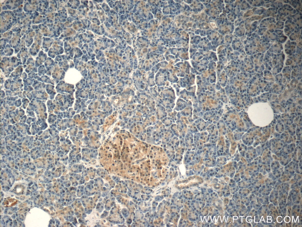 Immunohistochemistry (IHC) staining of human pancreas tissue using FOXA2 Polyclonal antibody (22474-1-AP)