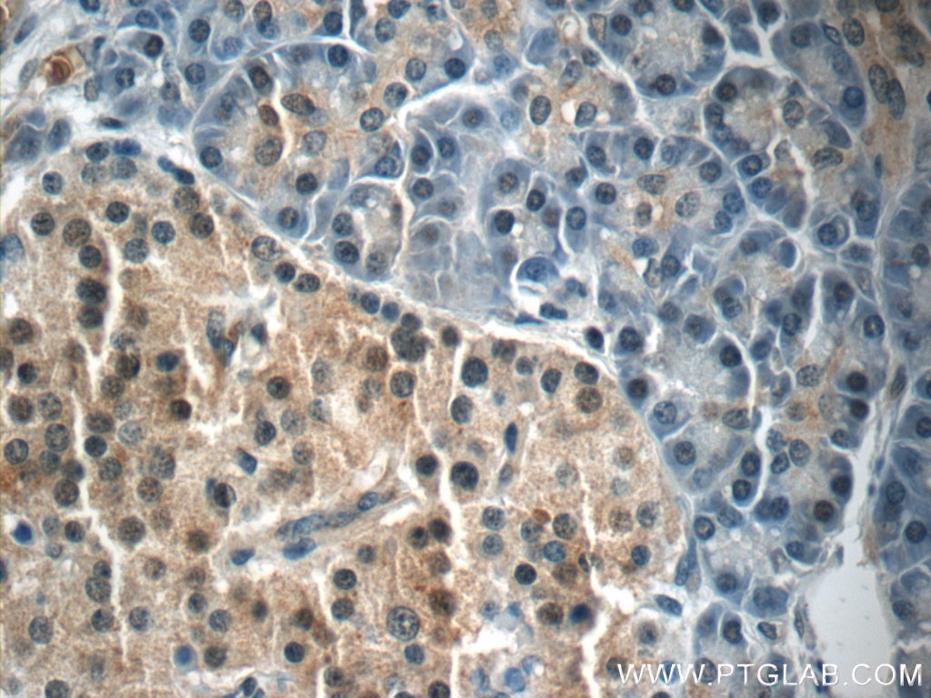 Immunohistochemistry (IHC) staining of human pancreas tissue using FOXA2 Polyclonal antibody (22474-1-AP)