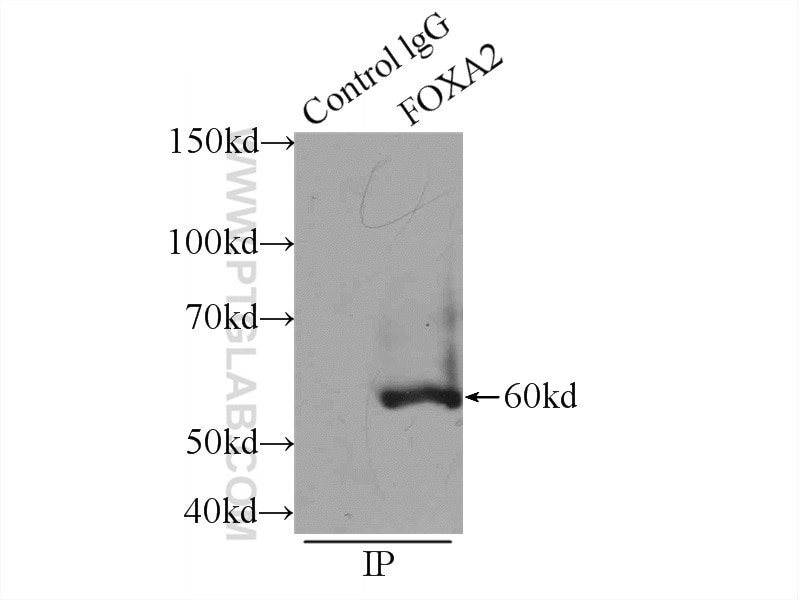 Immunoprecipitation (IP) experiment of HepG2 cells using FOXA2 Polyclonal antibody (22474-1-AP)