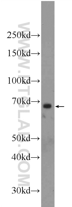 Western Blot (WB) analysis of HepG2 cells using FOXA2 Polyclonal antibody (22474-1-AP)