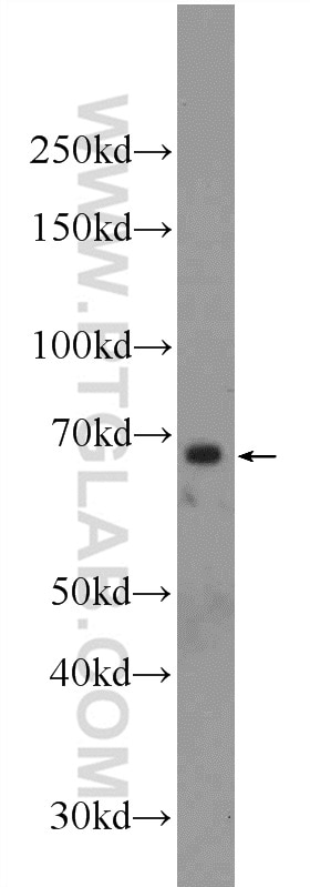 FOXA2 Polyclonal antibody