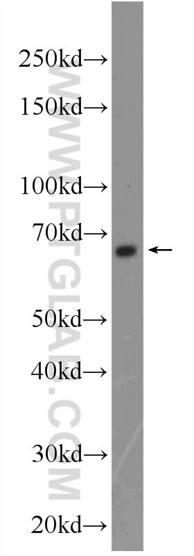 Western Blot (WB) analysis of PC-13 cells using FOXA2 Polyclonal antibody (22474-1-AP)