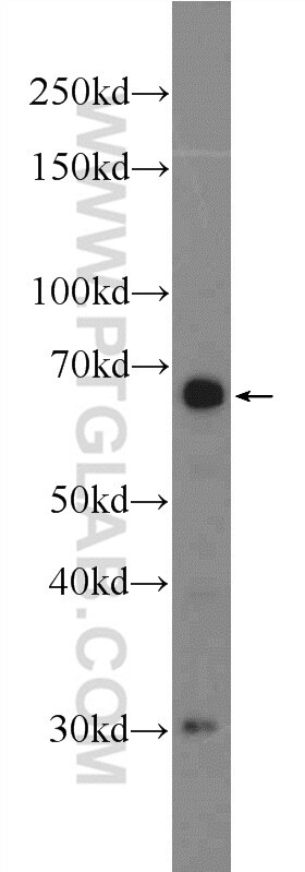 Western Blot (WB) analysis of A549 cells using FOXA2 Polyclonal antibody (22474-1-AP)