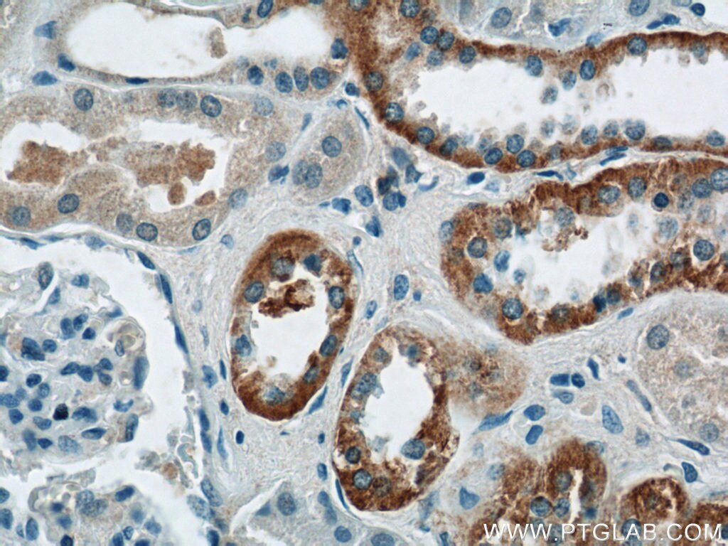 Immunohistochemistry (IHC) staining of human kidney tissue using FOXB1 Polyclonal antibody (24285-1-PBS)