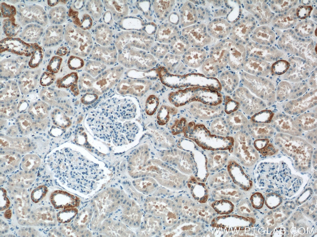 Immunohistochemistry (IHC) staining of human kidney tissue using FOXB1 Polyclonal antibody (24285-1-PBS)