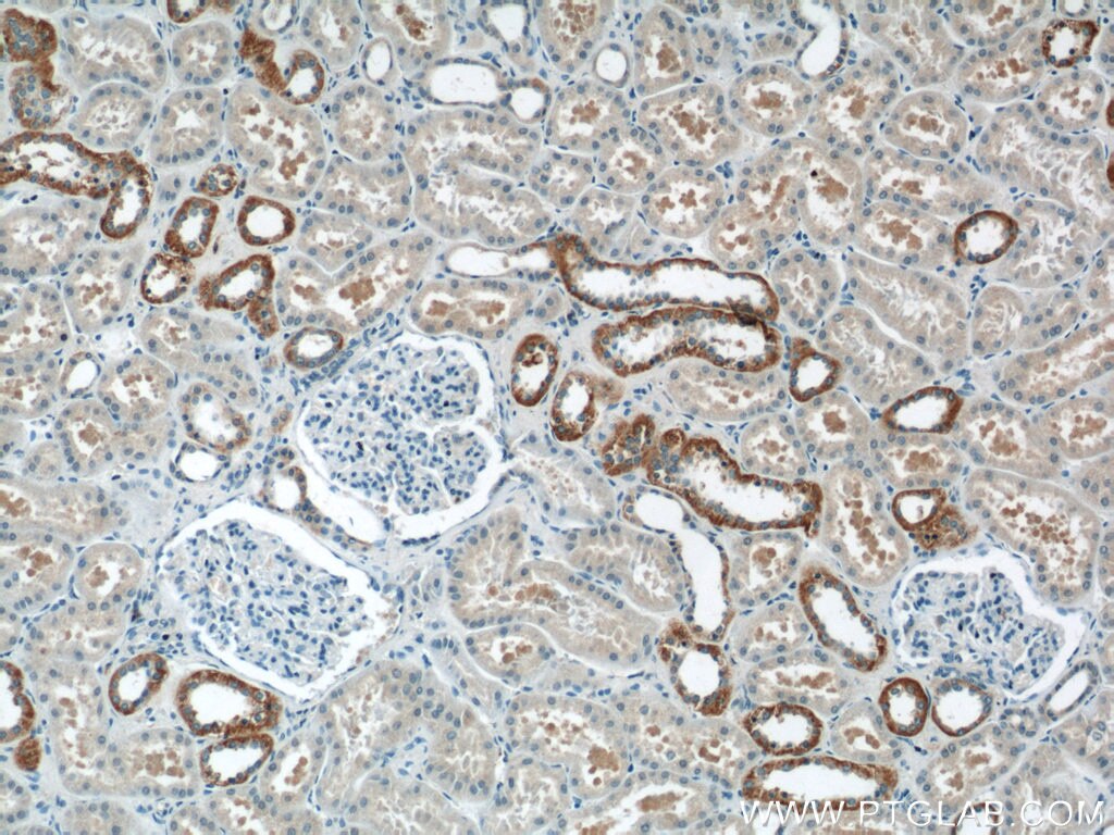 IHC staining of human kidney using 24285-1-PBS