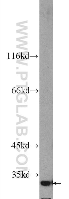 Western Blot (WB) analysis of mouse liver tissue using FOXB1 Polyclonal antibody (24285-1-PBS)